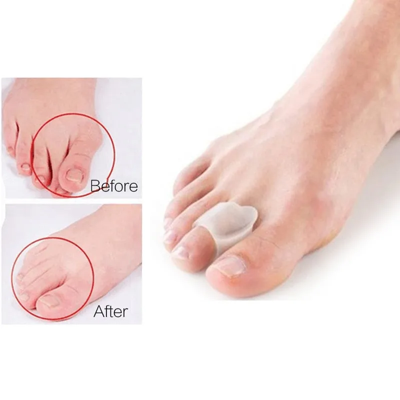 Big Toe Straightener Thumb Valgus Protector Silicone Gel Foot Fingers Toe Separator Bunion Adjuster Feet Pads Relief Foot Pain