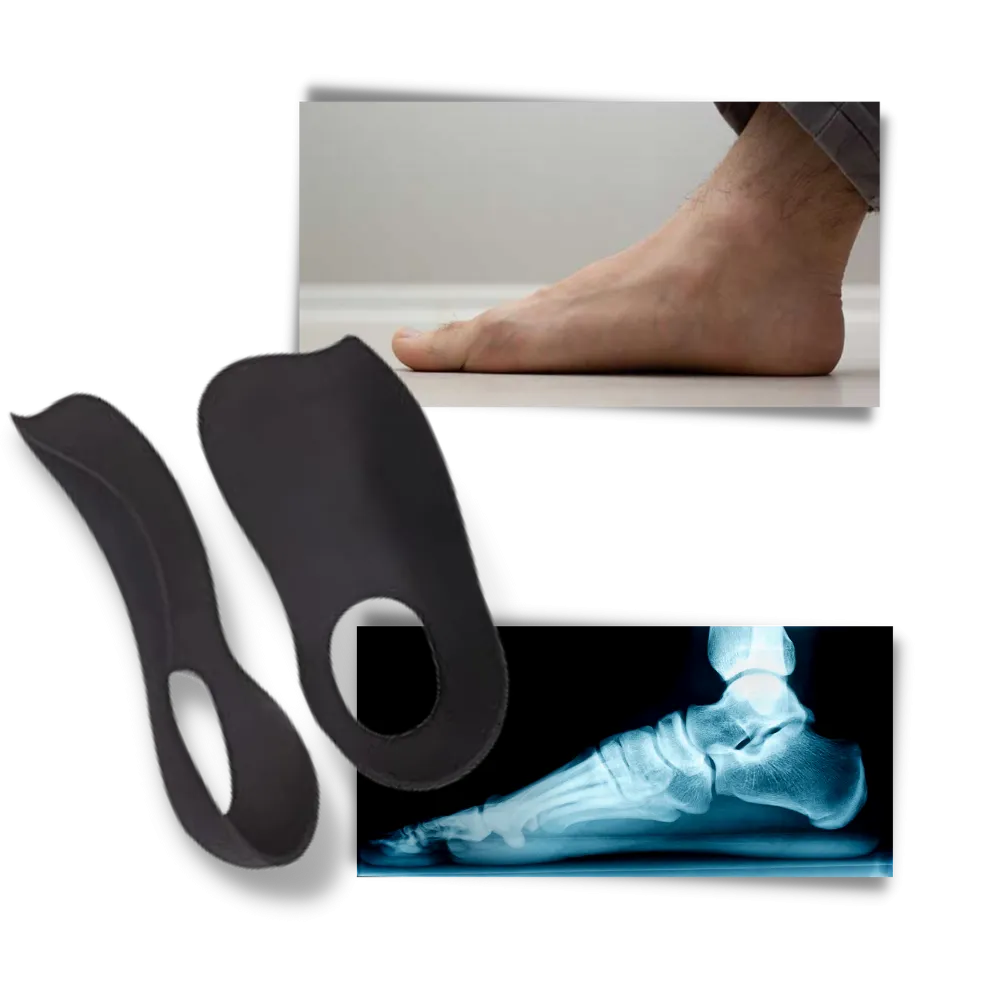 Orthopedic insoles for flat feet